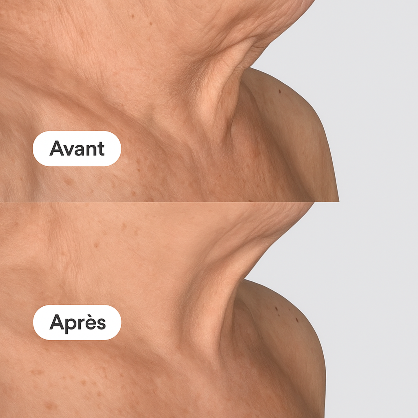 Masque V-Line Liftant